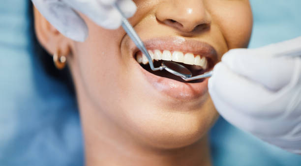 Best Emergency Gum Treatment in Richmond Heights, OH